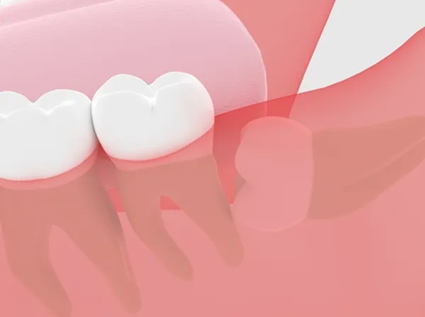 顎や口のトラブルを迅速処置