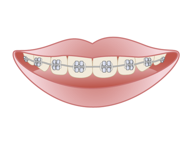 健康的で美しい歯並びにする矯正歯科治療を提供しています