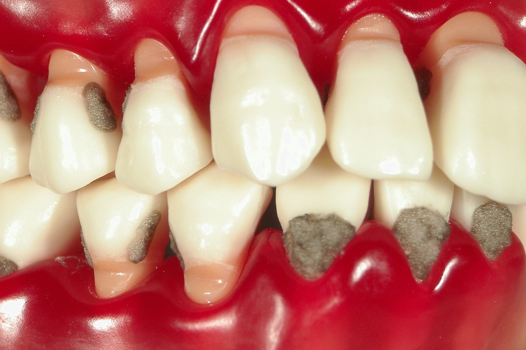 まず検査によって進行度を正確に把握することから始めます