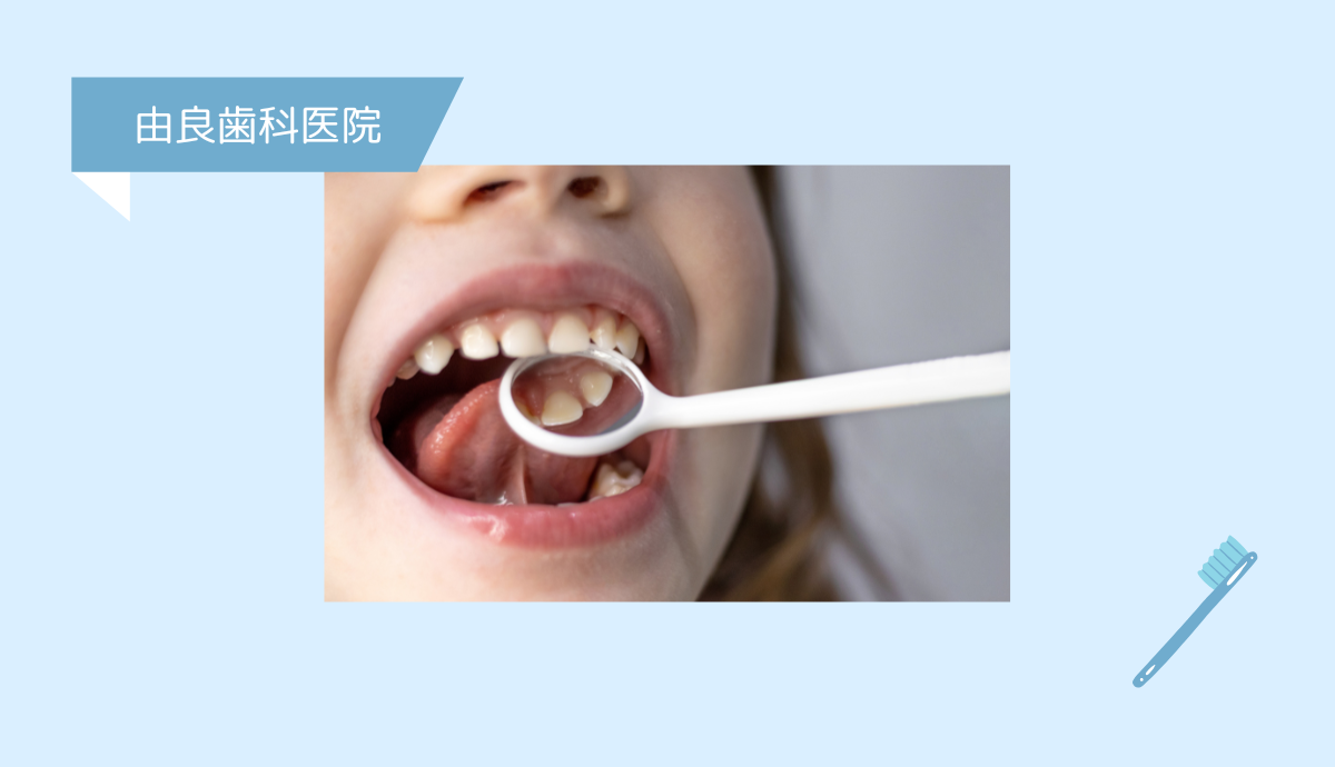 悪くなる前にを習慣に。定期チェックで歯を守る