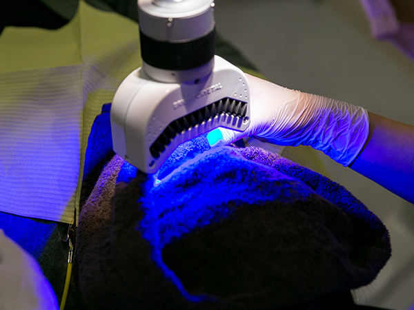 オフィスホワイトニング