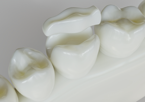 セラミックで自然な白い歯に