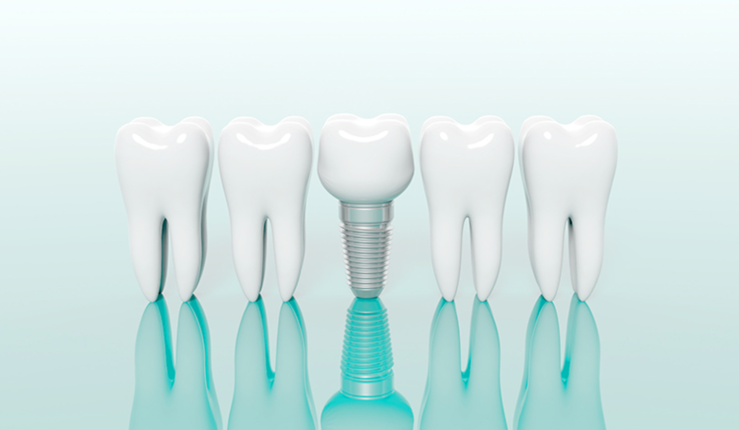 骨造成術も行っています。