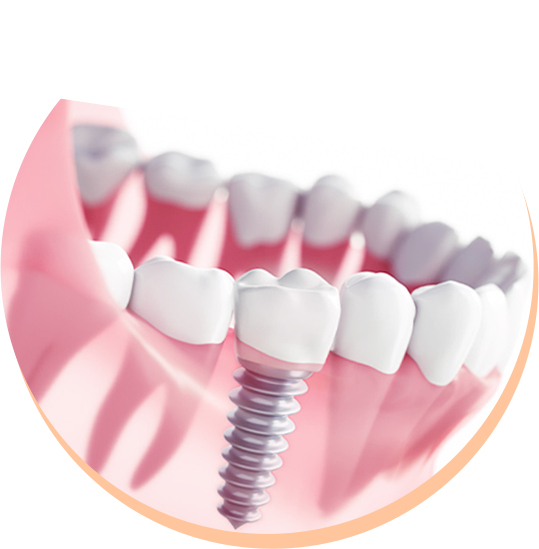 見た目も機能も優れた選択肢となり、しっかりとしたケアを行うことで長期間にわたって快適に過ごすことができます。