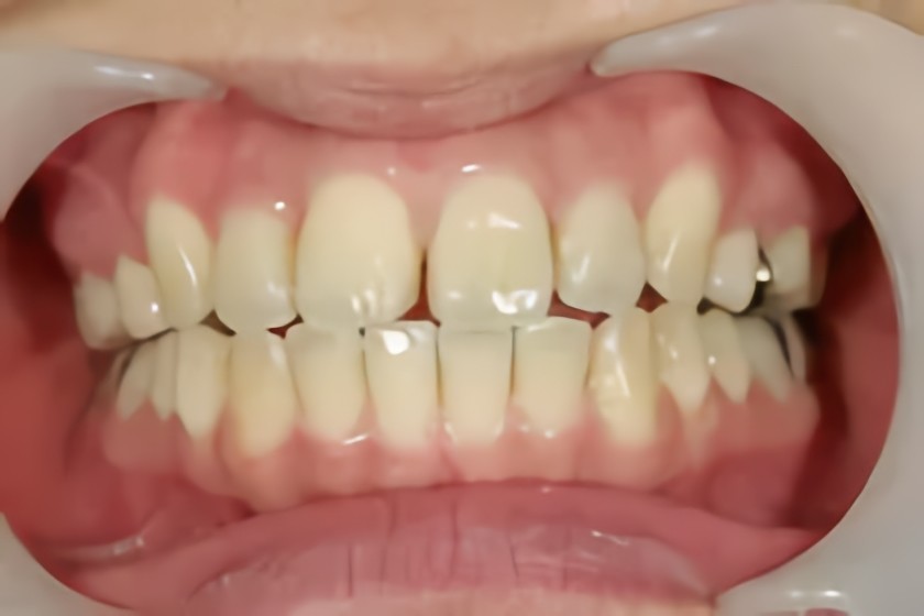 装置が全く見えません