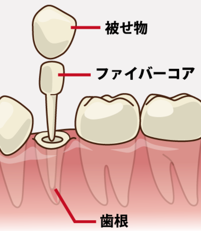 患者様の症状に合わせて、治療内容をご提案いたします