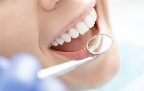 定期的な受診でむし歯を予防しましょう