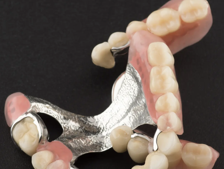 失った歯にふさわしい治療を提案します