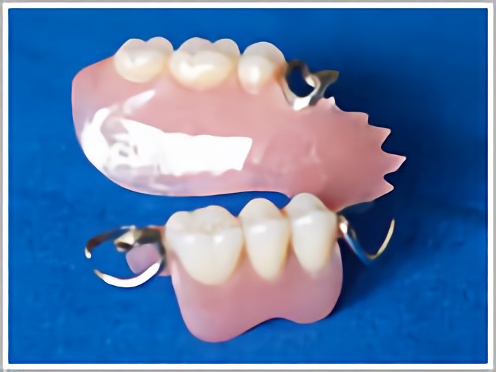 保険の部分入れ歯