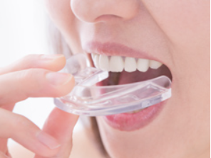 顎関節症治療用のマウスピース