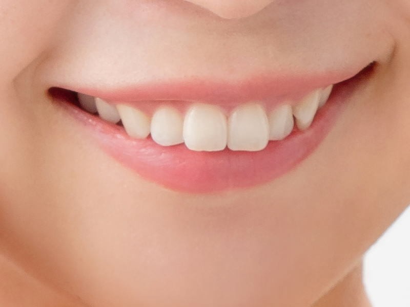 口元の印象をより美しく整えたい方は、ホワイトニング治療についてお気軽にご相談ください。