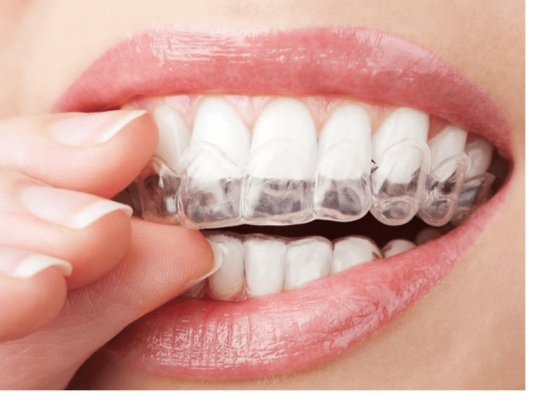 患者様のライフスタイルに合わせて治療方法を選べます。