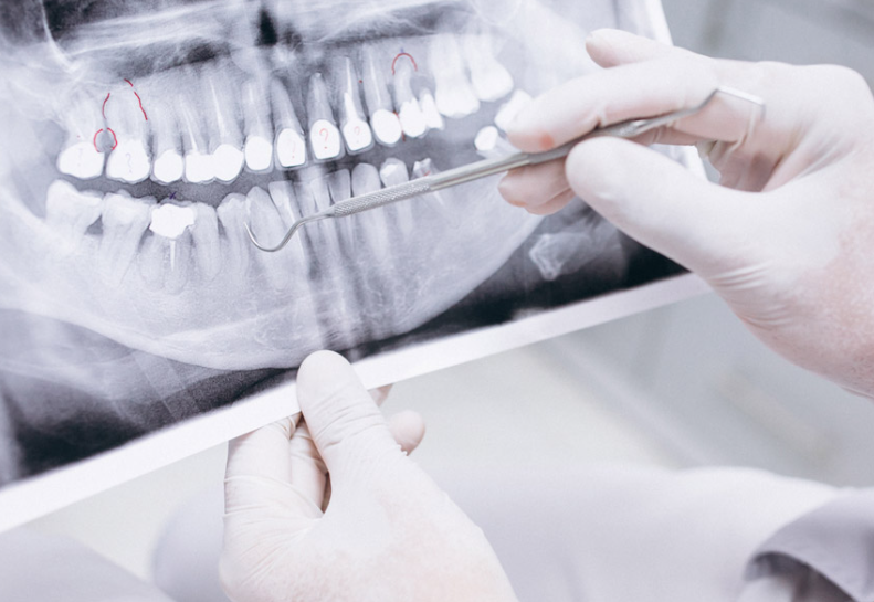 お口の状態をしっかりチェックし、治療からブラッシング指導まで行います