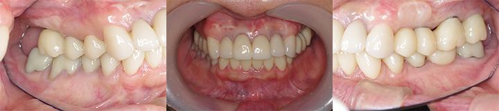 患者様一人一人の状況に合わせた治療計画を立て、最適な結果を追求しています。