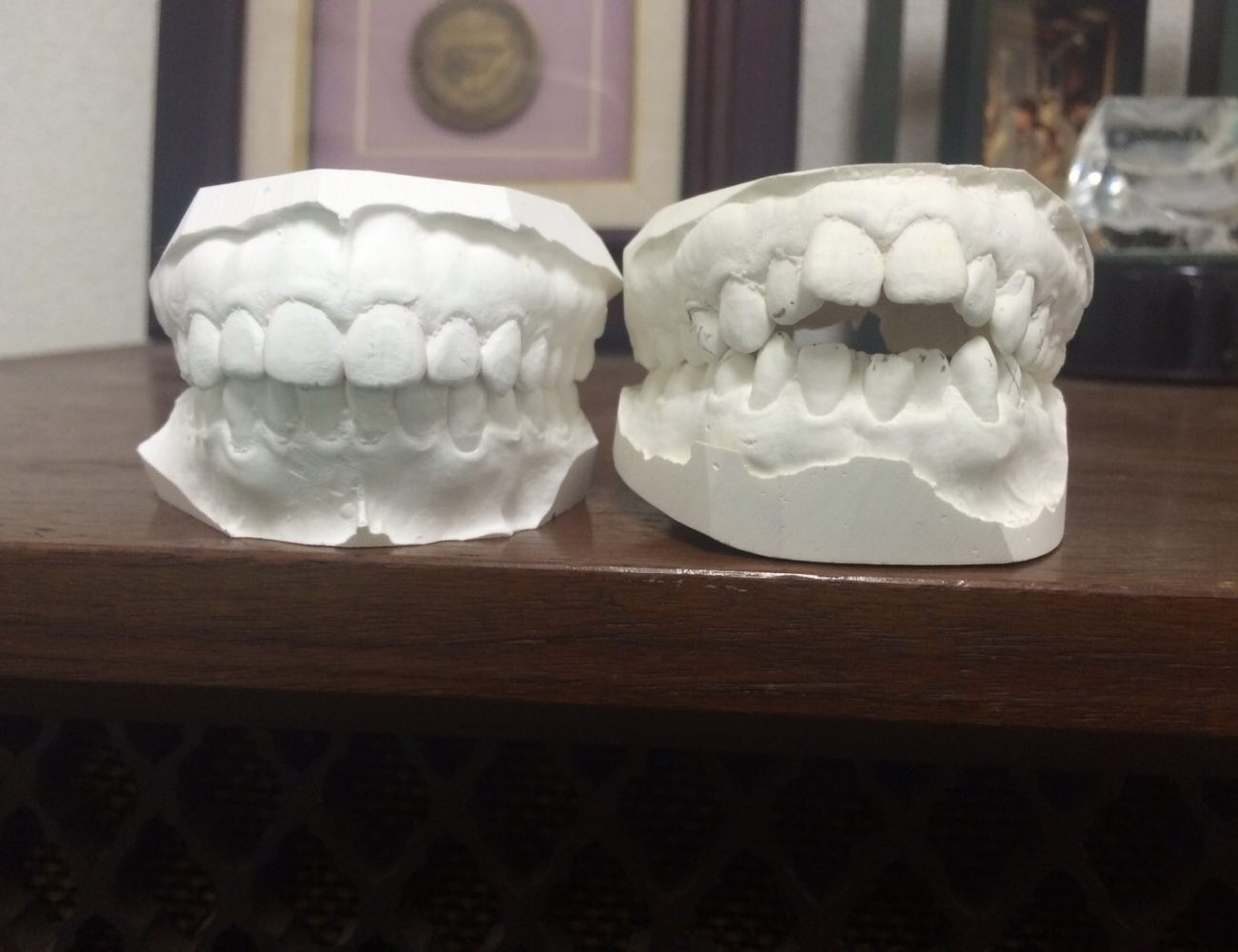 「矯正は痛い」「金具が目立つ」「治療期間が長い」といった従来のイメージを変える治療を目指しています。