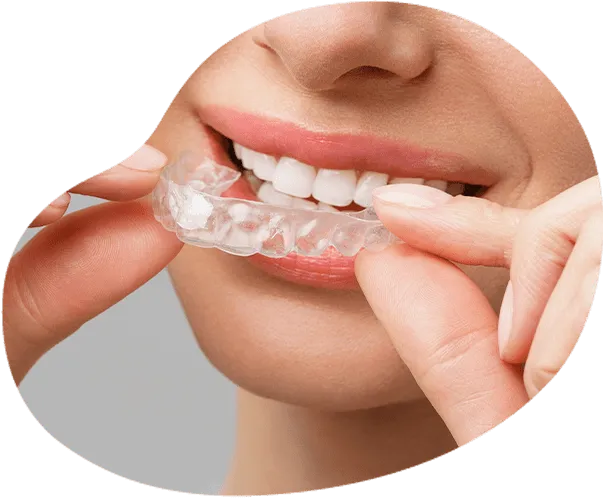 透明なマウスピースを使います