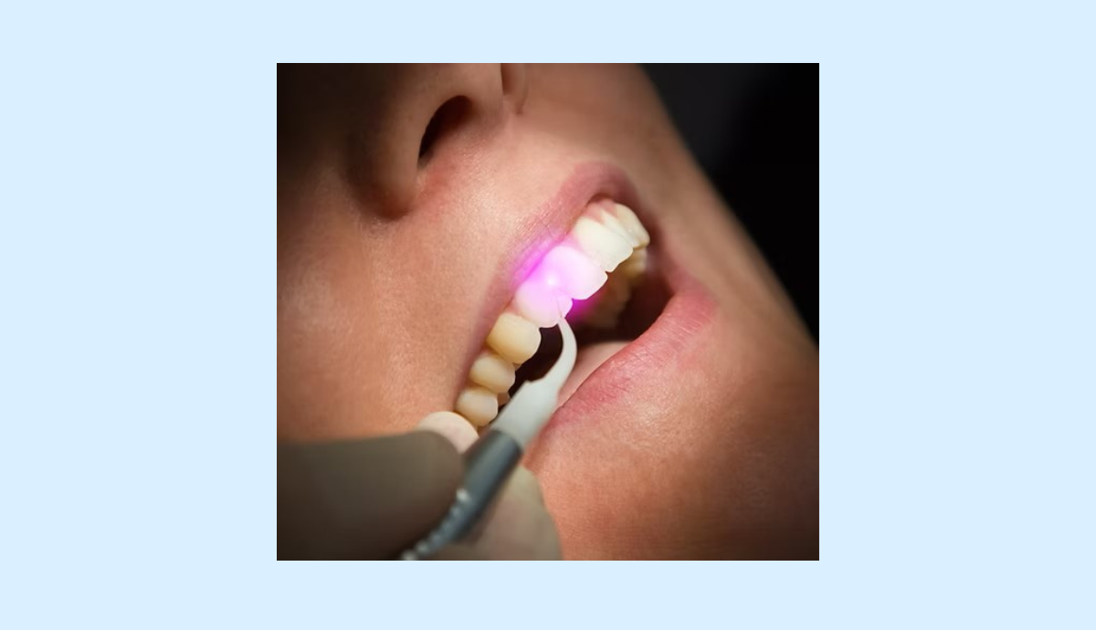 やさしい歯科診療