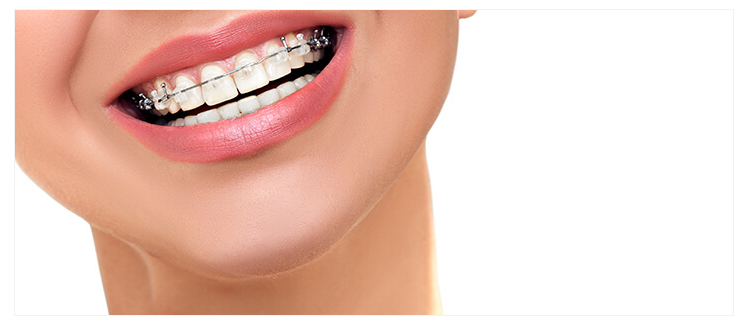 大人の矯正治療ならではのお悩みにも応えています