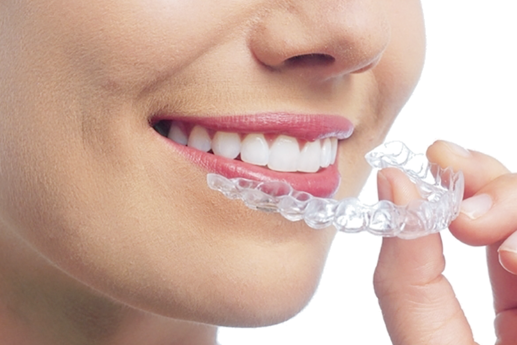 歯並びや噛み合わせが改善されると、見た目が良くなるだけでなく、口腔内の健康が向上し、食生活や会話など日常生活がより快適になります。