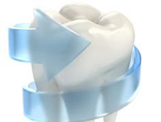 口腔内に存在する細菌が歯を溶かす病気です