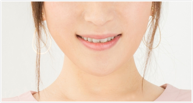 デンタルエステ