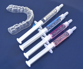 自然な白さを叶えるホワイトニングで明るい口元を