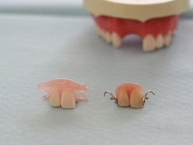 入れ歯治療は、失われた歯の機能を補い、快適な日常生活を取り戻すための大切な治療方法です。