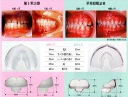 幼稚園から小学校低学年の児童を対象とした早期矯正治療に対応しています