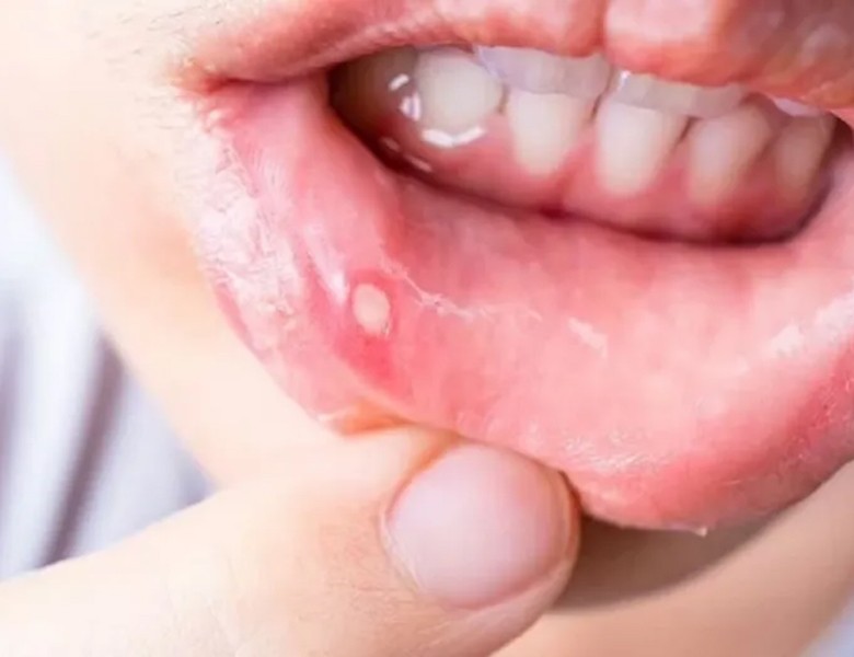 口腔粘膜疾患などにも対応しています