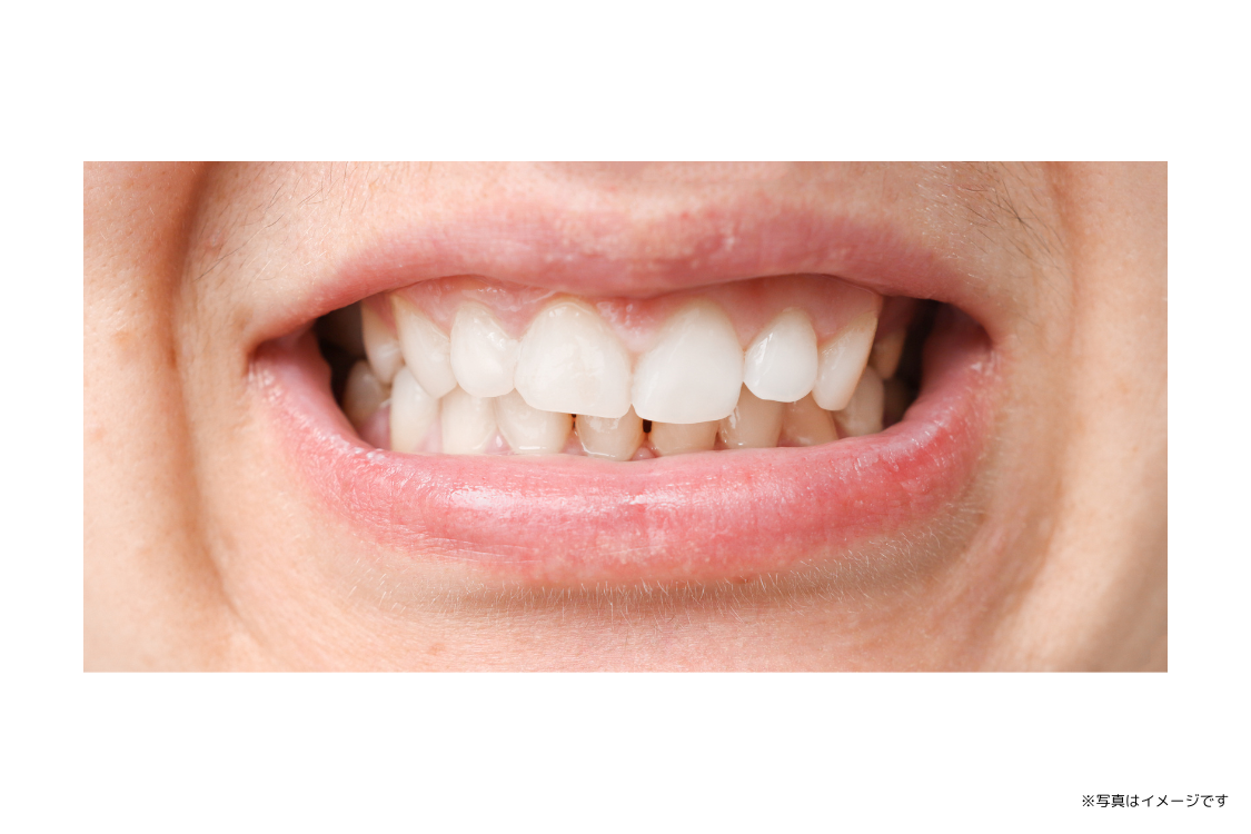 ①もっともっと笑顔を！ ②③イメージ画像