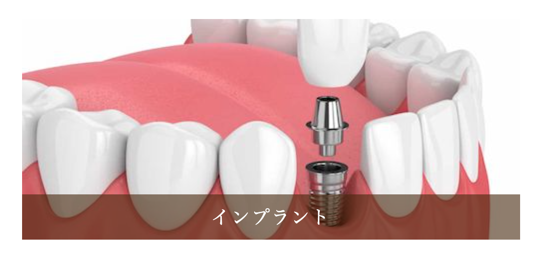 患者様の口腔内の状態を精密に診断した上で、最適な治療計画を立てています