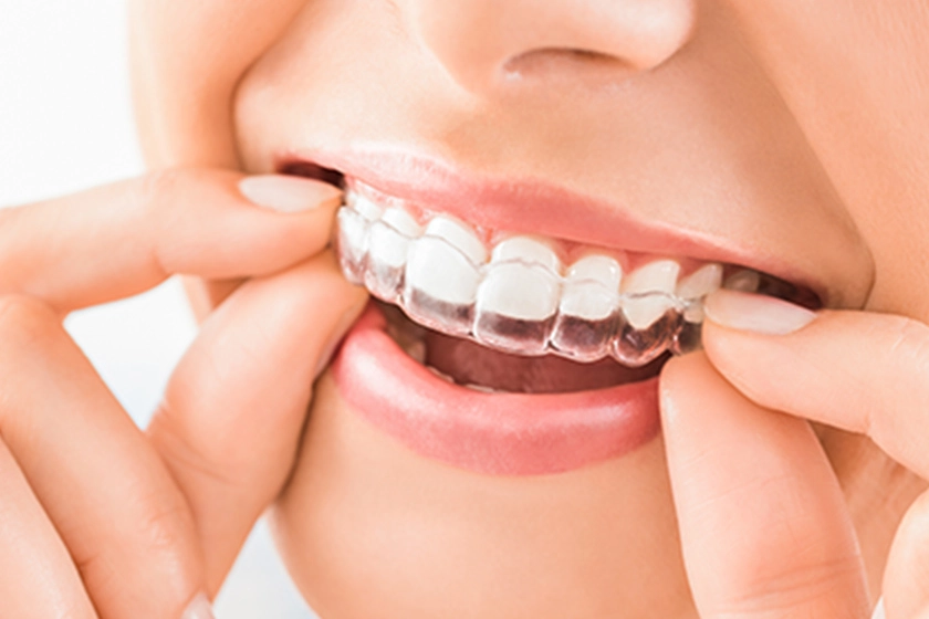 成長段階や歯並びに応じた方法を検討しています