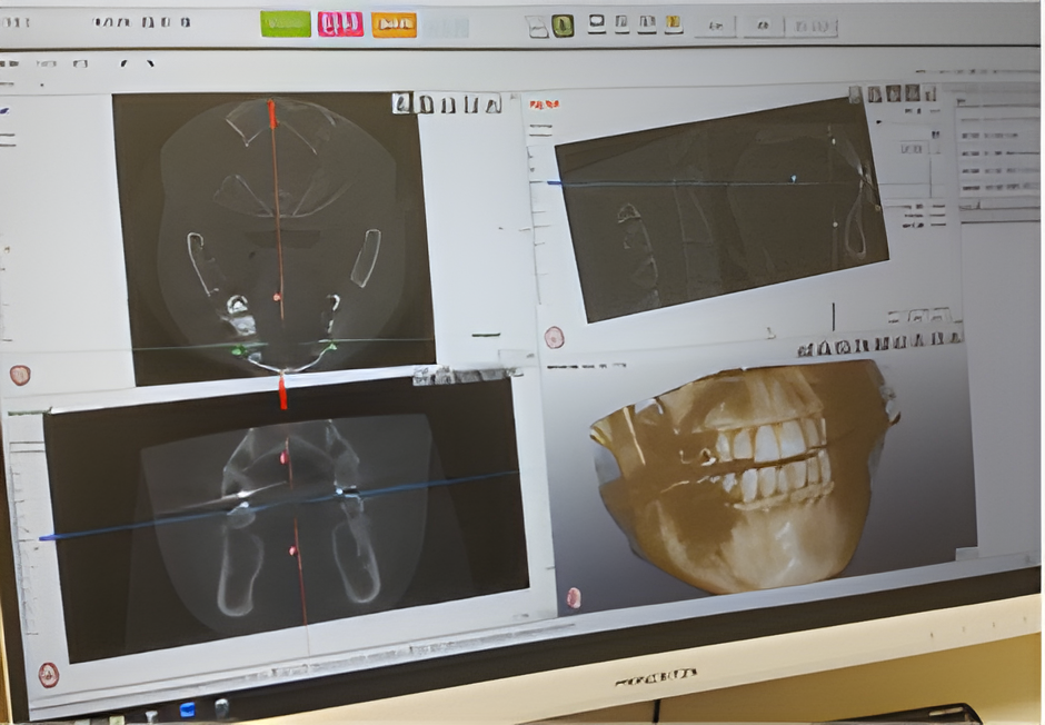 噛み合わせを良くして健康になろう