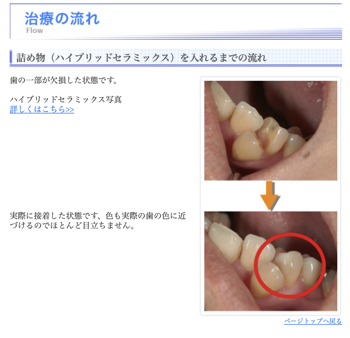 こぐち歯科周辺地図・治療例