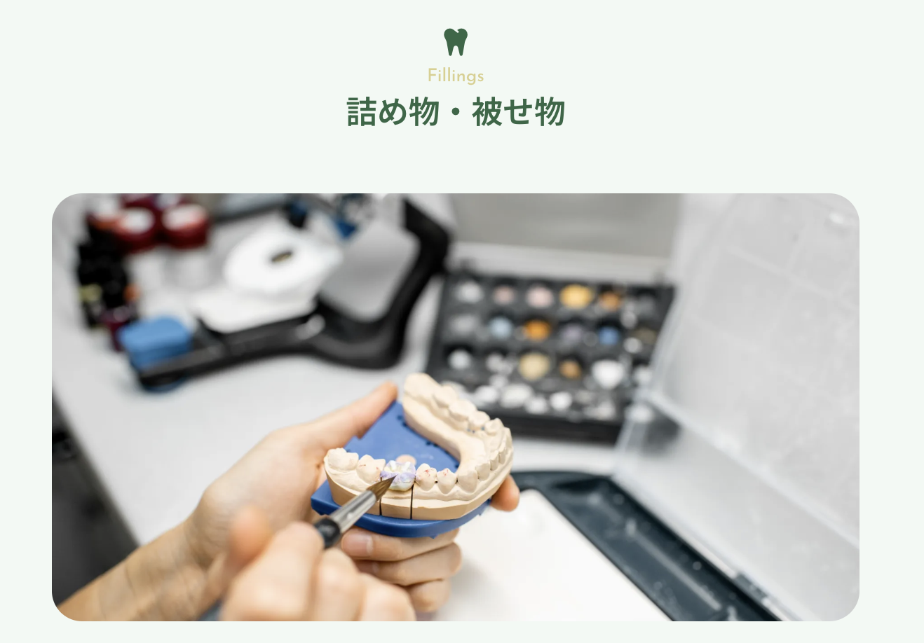患者様の歯の健康と審美性を考えた詰め物・被せ物の治療を行っています