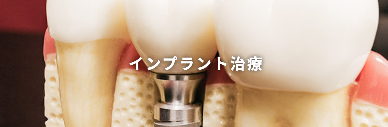 事前にCTを用いた精密な診査を行い、安全性を考慮した治療計画を立てています