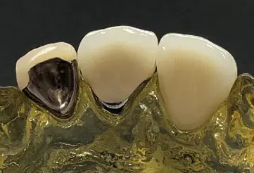 一人ひとりに合ったトータルビューティーを追求したセラミック治療