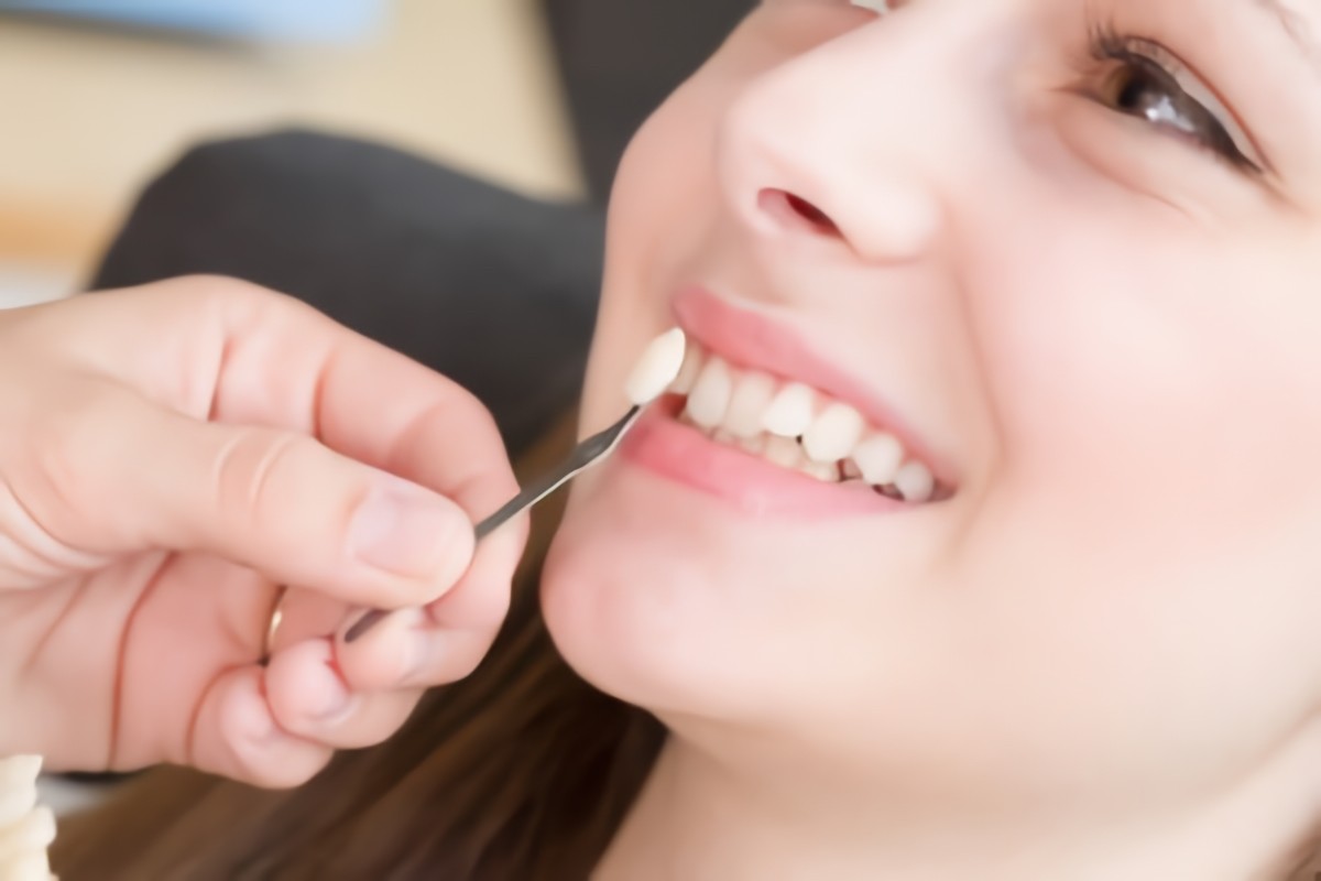 最適なホワイトニングをご提案いたします