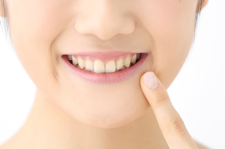歯周病対策を意識して健康的な歯を目指すことが大切です