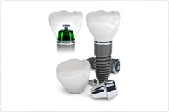 花野歯科医院の得意とするインプラント治療