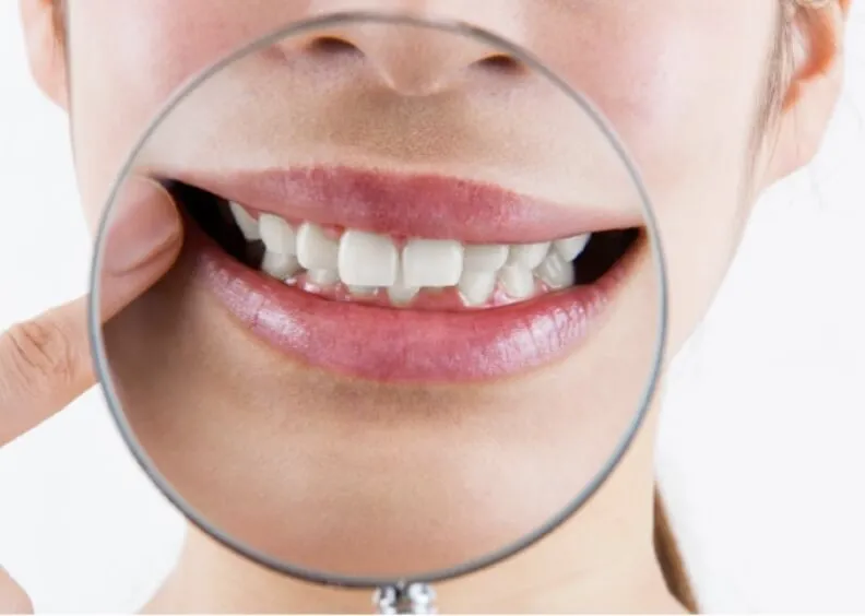 顎変形症や骨格的なズレを伴うケースに対して、咬合機能と見た目の両方を考慮した治療が行われています