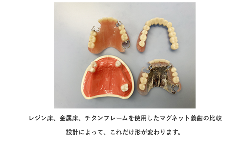 義歯（入れ歯）の治療を通じて、患者様の日常生活の質を高めるお手伝いをしております