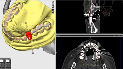 バイオニック社のビオナシステムを導入