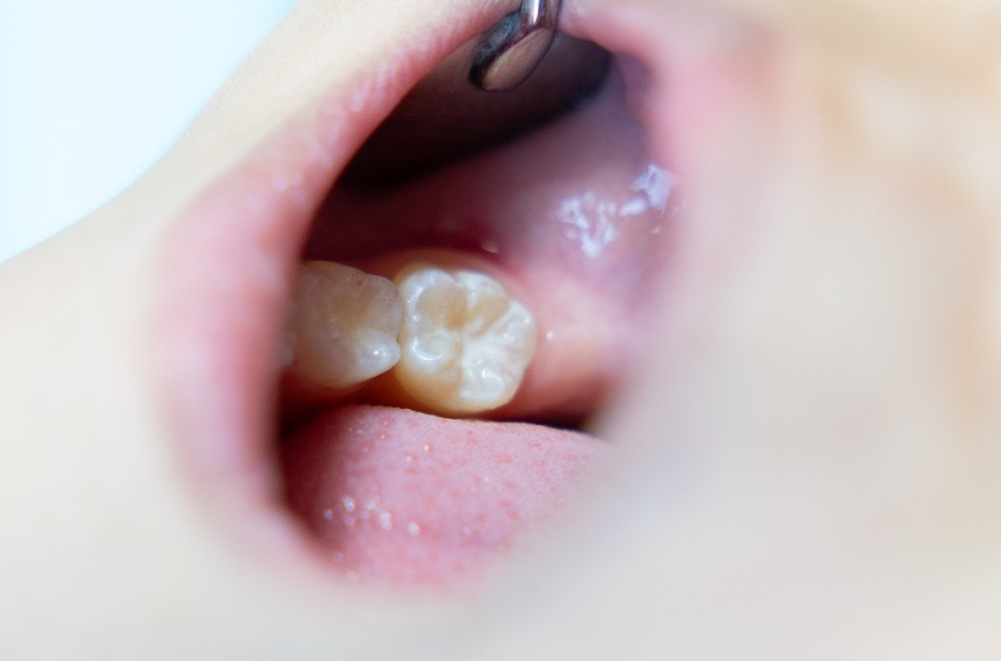 ※画像はイメージです。