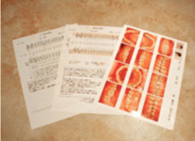 予防治療プログラムは患者様に好評です