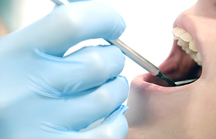 患者様の不安を和らげる優しい一般歯科治療