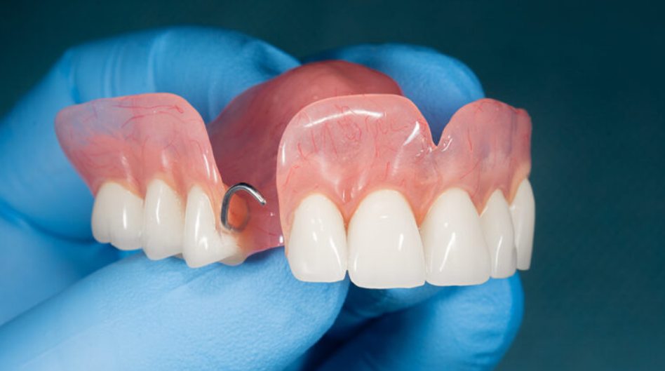 有床義歯のイメージ