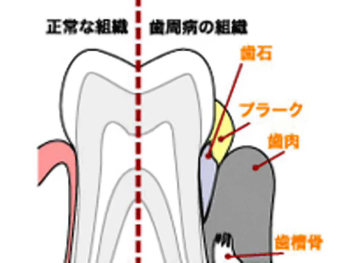 歯周病専門医による最先端ケア