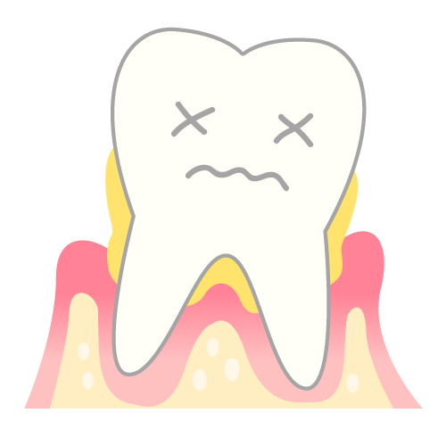 丁寧な治療で歯周病からの回復を目指す