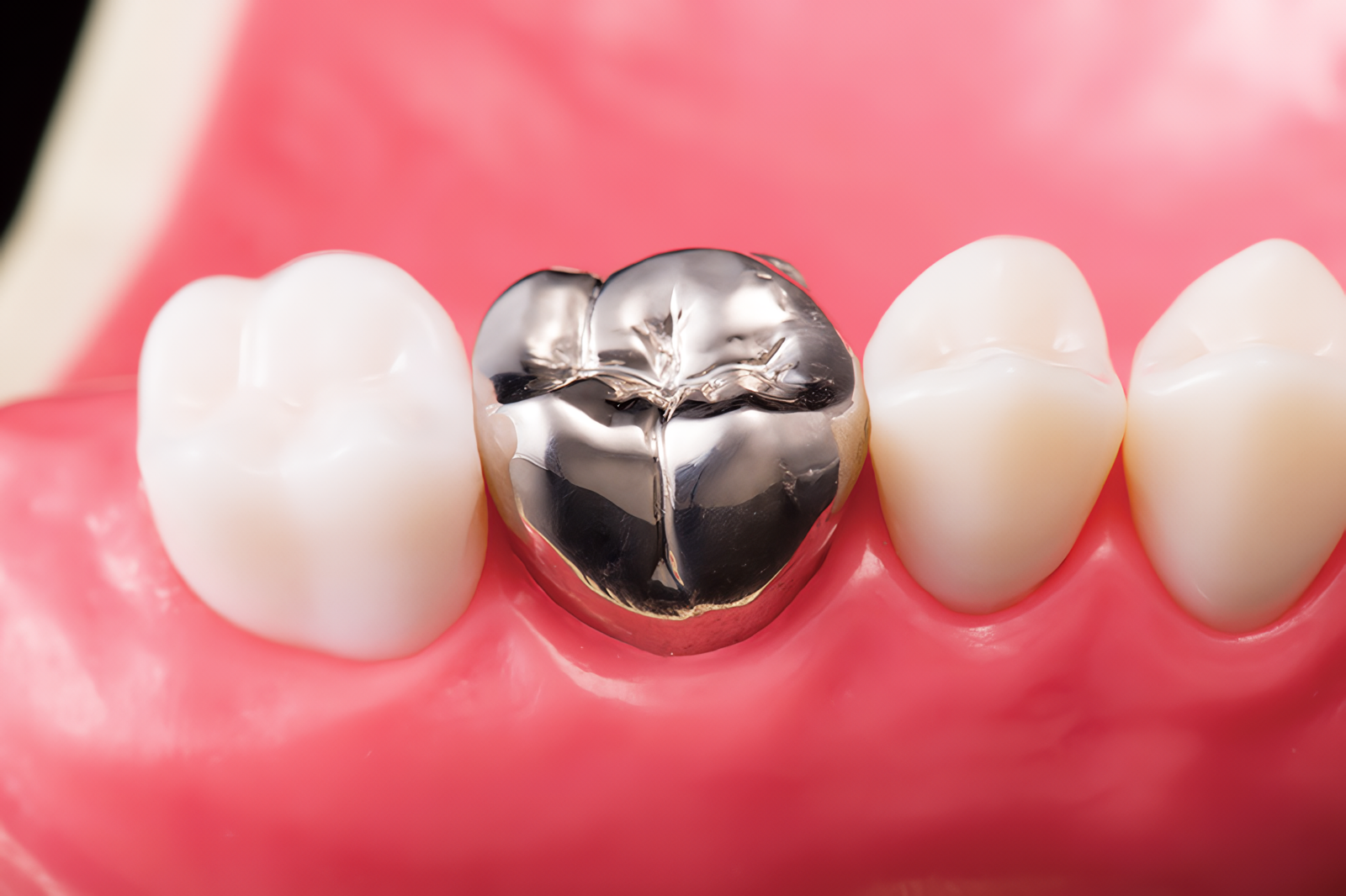 噛み心地と美しさを両立